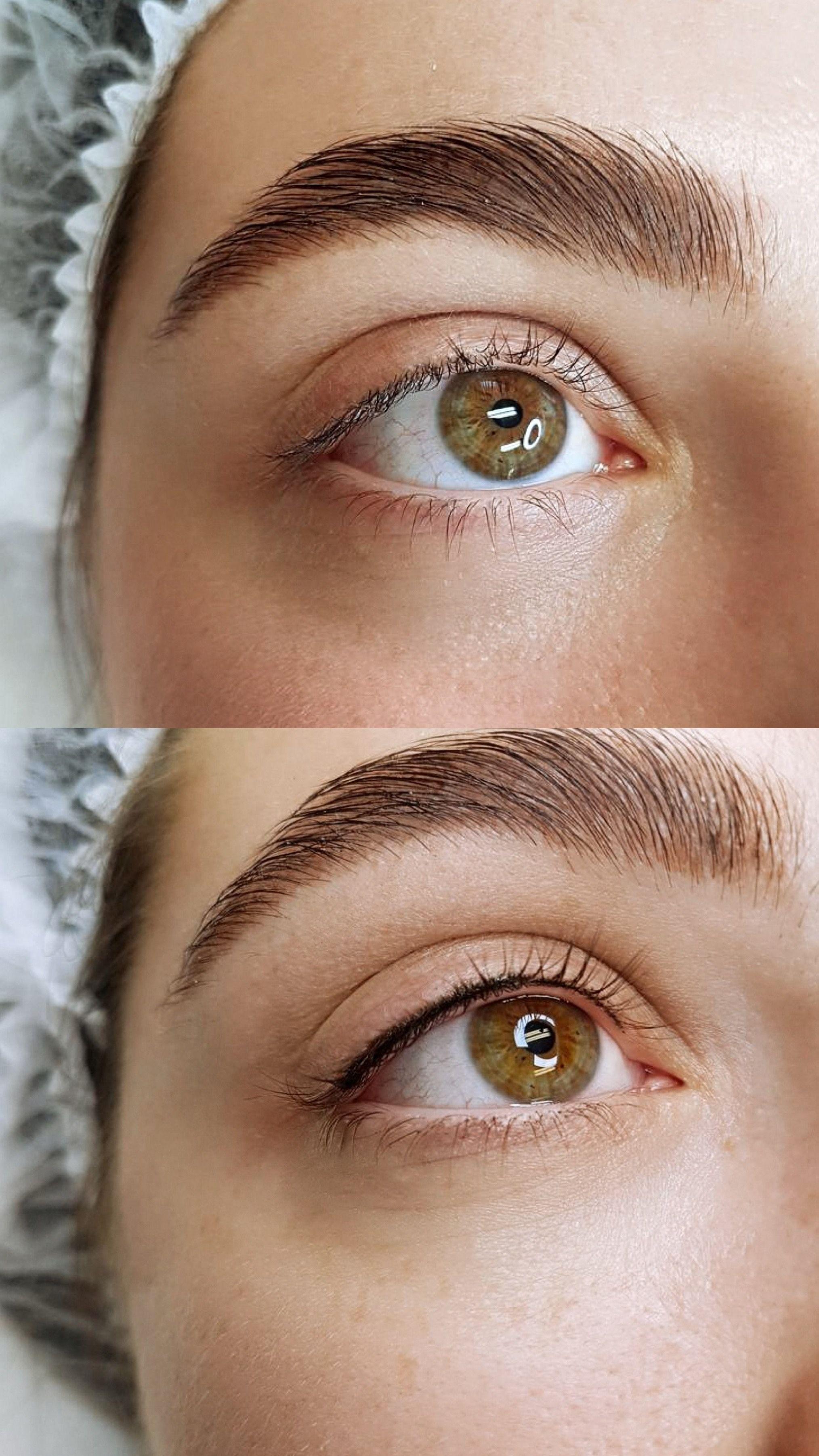 Lash Line Enhancement: What Healed Really Looks Like