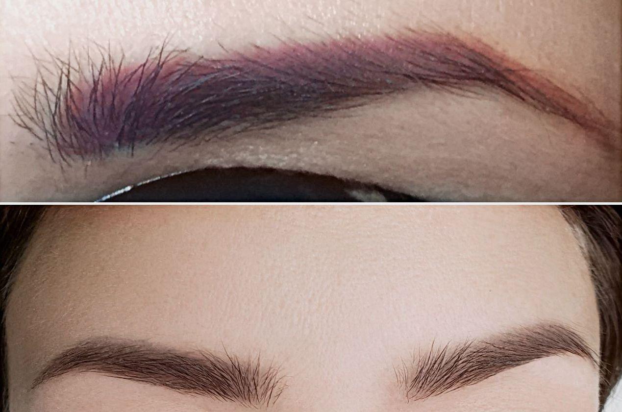 Can Old Eyebrow Tattoos Be Corrected?